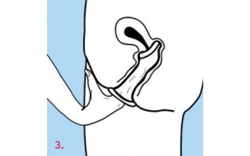 Femidom 3 Pk - Female Condom